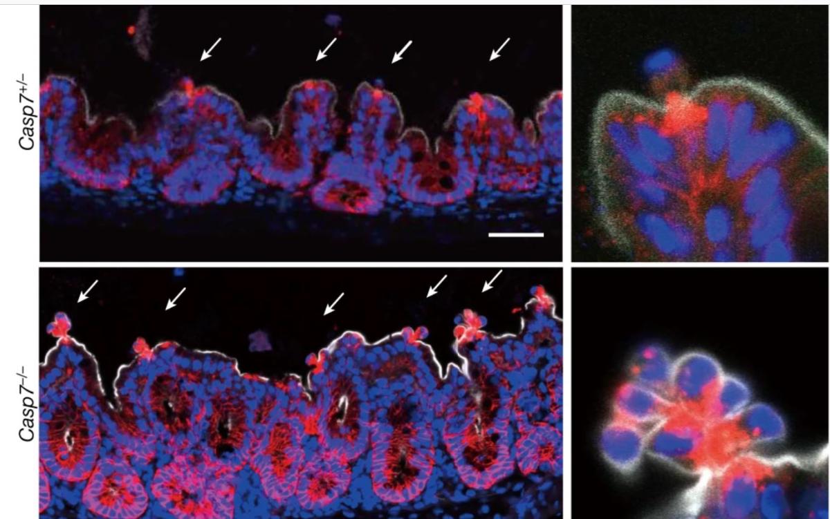 photo shows Caspase-7 activates ASM to repair gasdermin and perforin pores