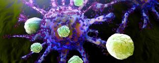 Tumor being attacked